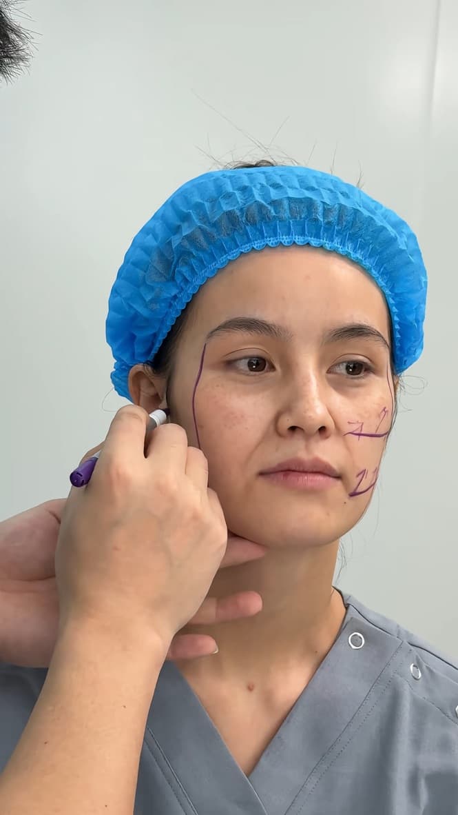 JadeLift facial planning