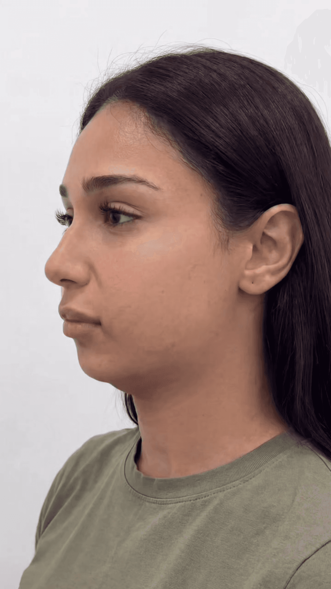 JadeLift patient profile documentation